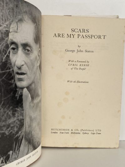 SCARS ARE MY PASSPORT