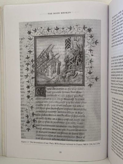 THE BODY BROKEN: Medieval Europe 1300-1520
